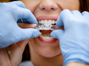 Invisalign®